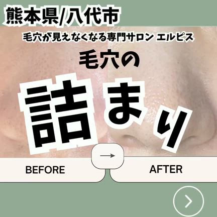 毛穴の詰まりケア5回の記事動画