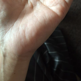 手がピクピクなった時の動画の画像
