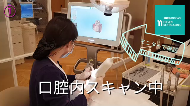 歯並びが気になる方はまずお気軽に検診からの記事動画