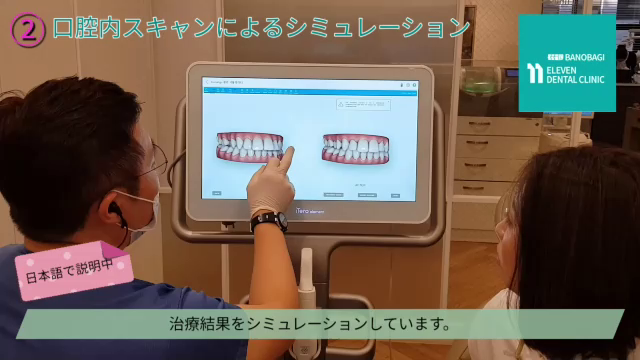 歯並びが気になる方はまずお気軽に検診からの記事動画