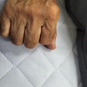 薬指のばね指の画像