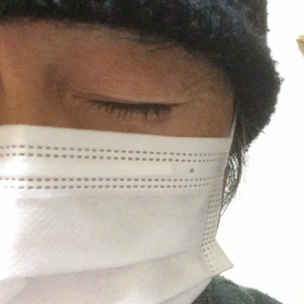 エイリアンその後の画像