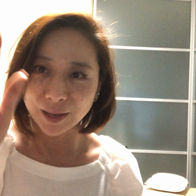 痒みが、出て来ましたよー3日目　　シミ取り放題後の私の顔面の画像