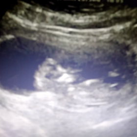 12週0日妊婦検診の画像