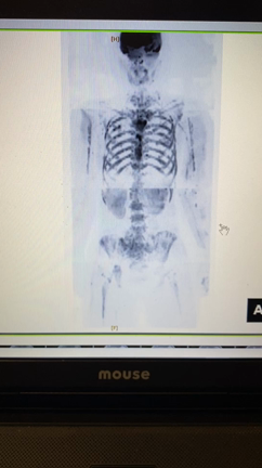 DWIBS検査の記事動画
