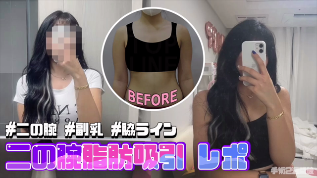 「二の腕だけ細くしたい」という方にお勧めです！の記事動画