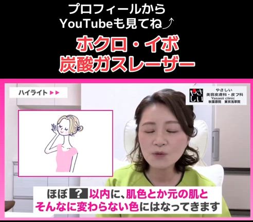 イボやホクロを除去する 炭酸ガスレーザーについての記事動画
