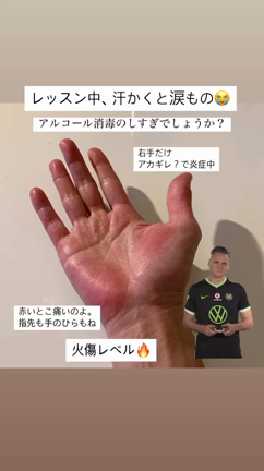 基本的に肌弱い。、、の記事動画