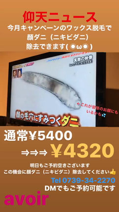 仰天ニュースの記事動画
