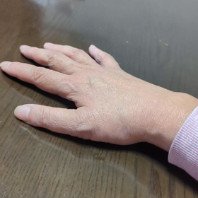 今の指の状態の画像