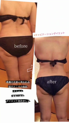6月のお知らせ  痩身キャンペーンの記事動画