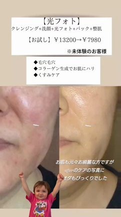 【光フォト】の魅力の記事動画