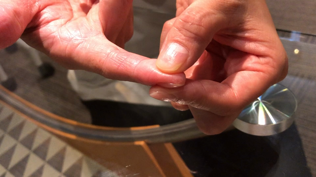 【熱中症予防チェック】お子様の指の腹の弾力はどうですか？の記事動画