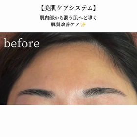 ☆水分チャージで乾燥撃退！☆の画像