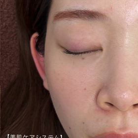 ☆一回でこの肌の透明感☆の画像