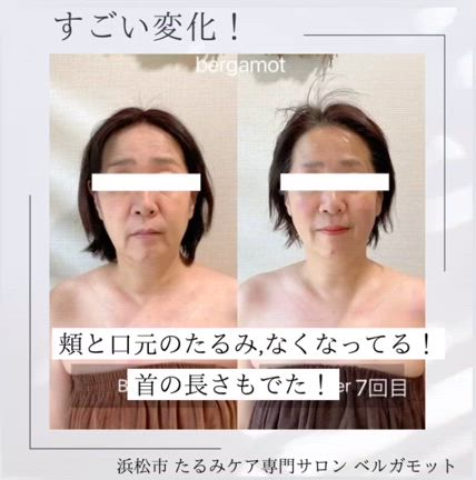 ベルガモットのたるみケアならここまで変われます！！の記事動画
