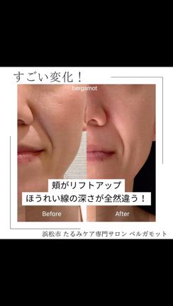 たるみはメイクで隠せない！の記事動画