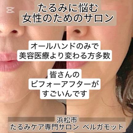 たるみに悩む女性のためのサロンの記事動画