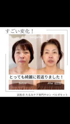 信じられない！こんなに綺麗に若返りました✨の記事動画
