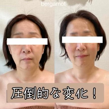 圧倒的な変化！の記事動画