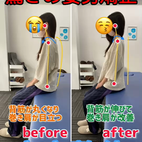 驚愕！！姿勢改善ですの画像