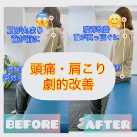 頭痛・肩こり劇 的改善✨✨の画像