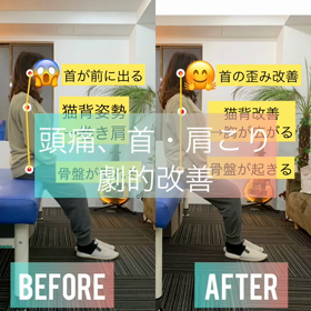 猫背！！劇的改善✨✨の画像