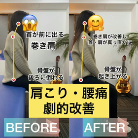 頭痛・肩こり・腰痛劇的改善✨✨の画像