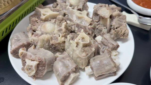 両顎再手術+ASO　術後1年レビュー（固定ピン除去）の記事動画