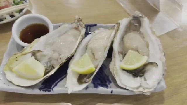 ひどい顎なしと口ゴボ、下顎矮小症してはいけない治療・手術⑤-両顎手術の記事動画