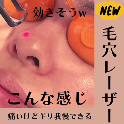 新施術★毛穴撲滅レーザーの記事動画