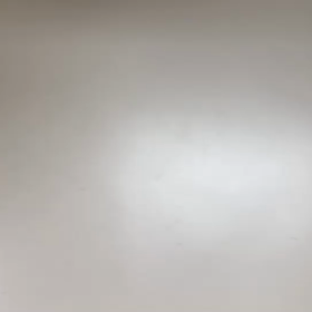 摘出した胆嚢　胆石がゴロゴロ…の画像