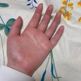 手の専門の先生の所への画像