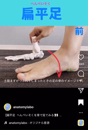 衝撃！土踏まずが落ちてる骨がこんな感じだったとは！の記事動画