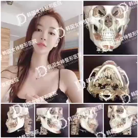【清潭(チョンダム)女神美容外科】輪郭3点のビフォーアフターを3DCTで比較♥の画像