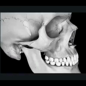 【清潭(チョンダム)女神美容外科】必見☆3DCTで見る頬骨縮小方法のやり方！の画像