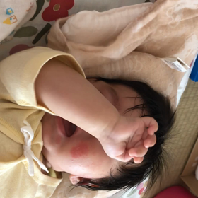 鼻くそ取れたよの画像