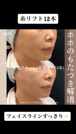 2024/10/01の記事動画