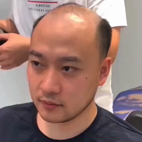 かつらの画像