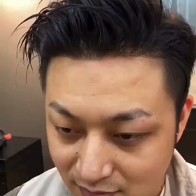 生え際シートの画像