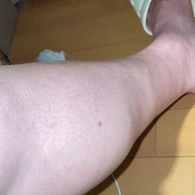 ファスキなんて！の画像