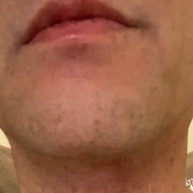 構音障害はの画像