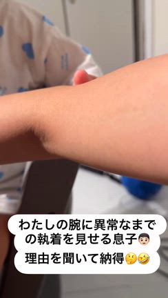 息子がわたしの腕に執着する理由の記事動画