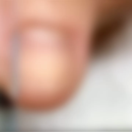 【深爪矯正】☆経過観察☆ 初回＆2回目の比較☆動画あり【天神店】の記事動画