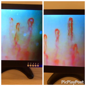 毛細血管 動画♡の画像