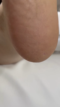 お客様のお手入れのご紹介☆セルフケアに限界を感じたかかとのガサガサの記事動画