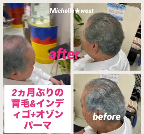 2ヶ月ぶりのオゾンパーマ&育毛の記事動画