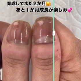 長年のお悩み一緒に解決していきましょう！見るたびに嬉しくなるお爪に☆・・・の画像