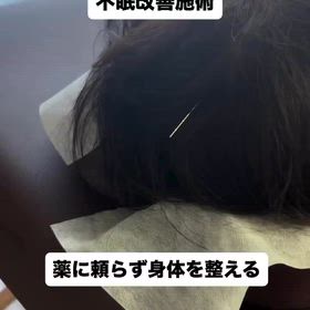 不眠改善施術 薬に頼らず身体を整えるの画像