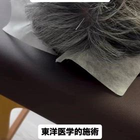 高血圧に対する治療 東洋医学的施術の画像